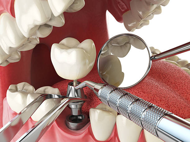 Fast & Reliable Emergency Dental Services in CT